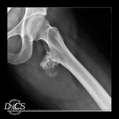X-Rays | Diagnostic X-Ray Consultation Services