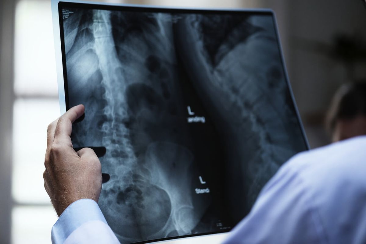 DIAGNOSTIC XRAY What You Need to Know About Medical Second Opinion Services.jpg