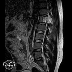 MRI Image - Diagnostic X-Ray Consultation Services