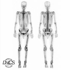 Human Skeleton | Diagnostic X-Ray Consultation Services